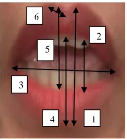 Fig. 4 Artificial Neural Network 