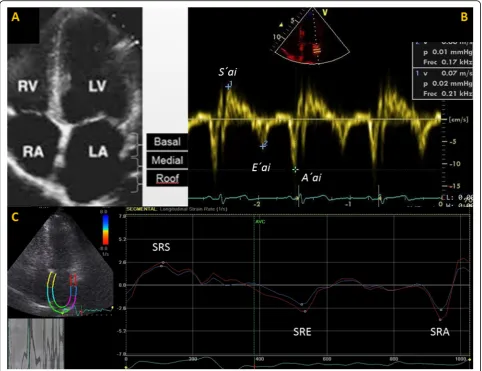 Fig. 1 Methodology used for the evaluation of LA lateral wall by TDI and SRI. A) Subjective division of the LA lateral wall in three segments; B)conduit function),identified: SRS (evaluates reservoir function); SRE (evaluates conduit function) and SRA (eva