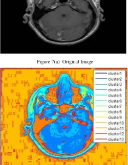 Figure 6(b)  Segmentedl Image 
