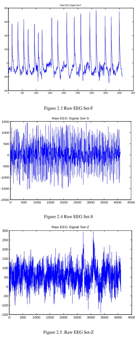 Figure 2.3 Raw EEG Set-F 
