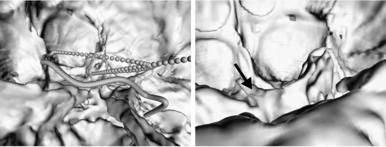 FIGURE 3. An interpolated flight path. FIGURE 4. A view inside the cranium.