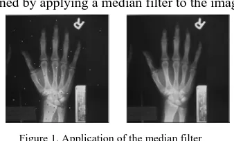 Figure 1. Application of the median filter 