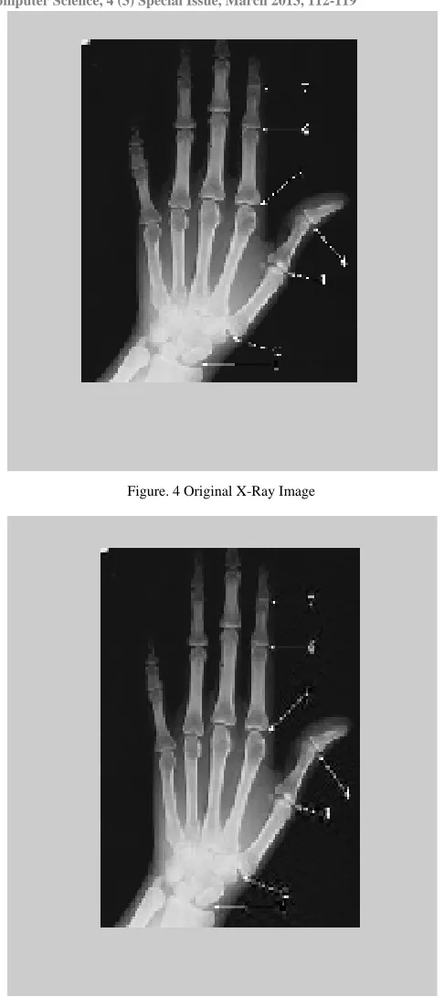 Figure. 4 Original X-Ray Image 