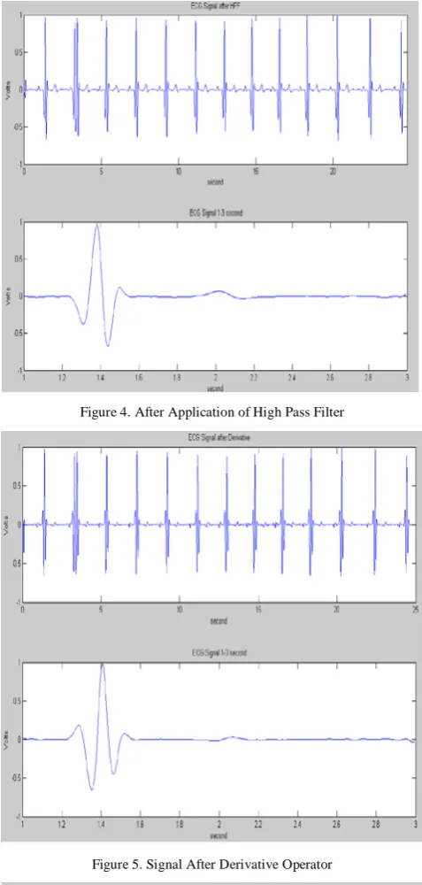 Figure 4. After Application of High Pass Filter 