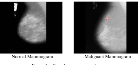 Figure 1.  Sample mammogram images 
