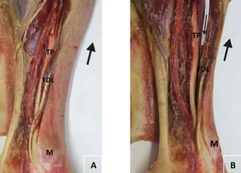 Figure 3Audit of placement of intramuscular electrodeAudit of placement of intramuscular electrode