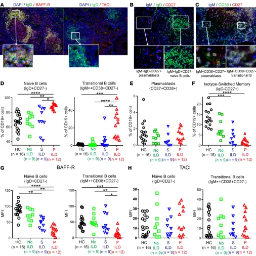 Figure 6. BAFF-R+with P ILD but (cantly lower in P ILD patients compared with CVID patients without ILD