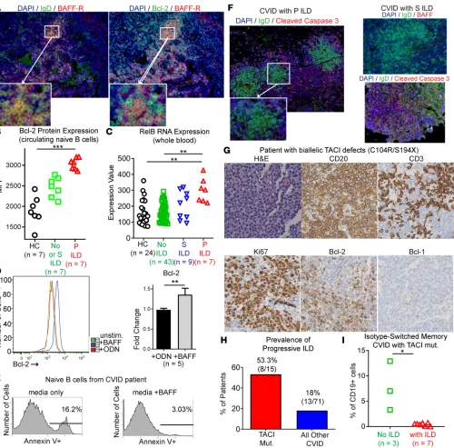Figure 7. Naive B cells express Bcl-2 in response to BAFF-R signaling to resist apoptosis and promote progression of CVID ILD