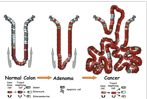 Figure 2. Model for colon cancer initiated by stem cells. diff erentiate while moving up the crypt in about 5 days