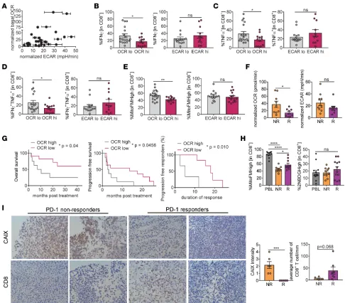 Figure 4. Oxidative metabolism of tumor cells and hypoxia are associated with decreased antitumor immunity and poor clinical response to PD-1 blockade therapy in patients.tabulated normalized ECAR of isolated tumor cells from melanoma patients that progres