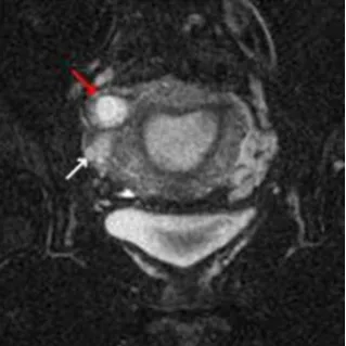 Figure 2: MRI of the pelvis. 