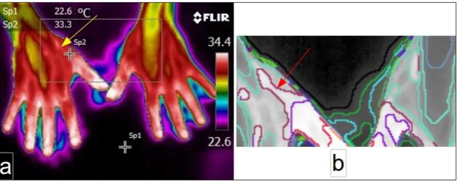 Fig. XX.3 