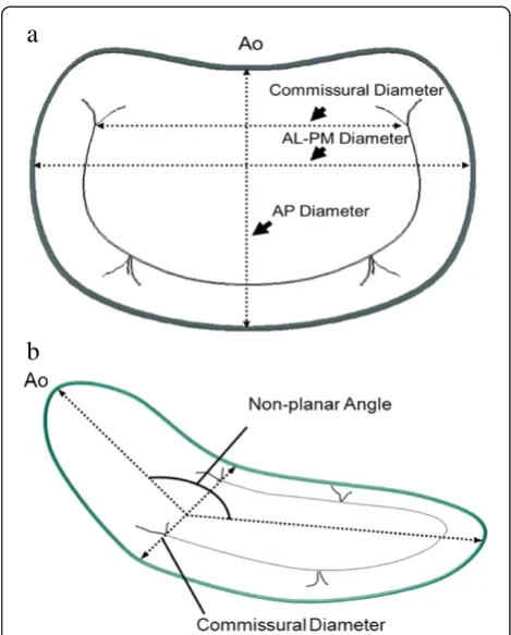 Fig. 2 Shematic illustration of a phantom mimicking the mitral valvecommissure(Surgeon view) after labeling the circumference by mouse clicking(circular blue points) in a cropping plane perpendicular to the virtualplane