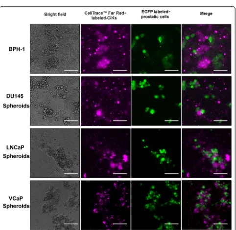 Fig. 4 Detection of apoptotic cells in prostatic cells upon 1 h incubation with P-DC-CIK or NP-DC-CIK by TMR red-based TUNEL assay.sensitized dendritic cells-cytokine-induced killer cell preparation,images show the TUNEL-positive apoptotic cells induced in