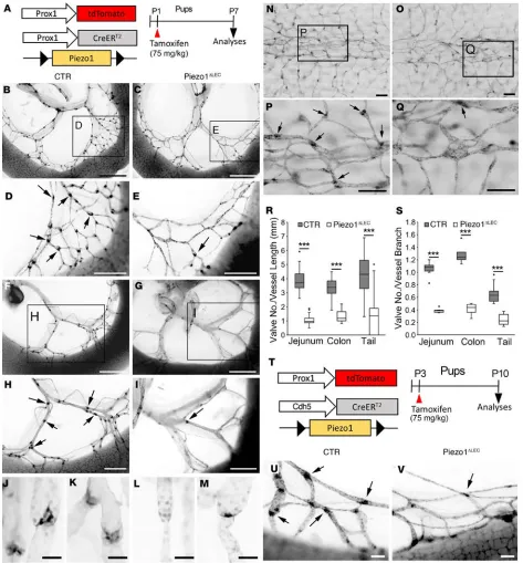 Figure 1. Piezo1 is essential for lymphatic valve development. (the mesenteric lymphatic valves in the jejunum were analyzed at P10