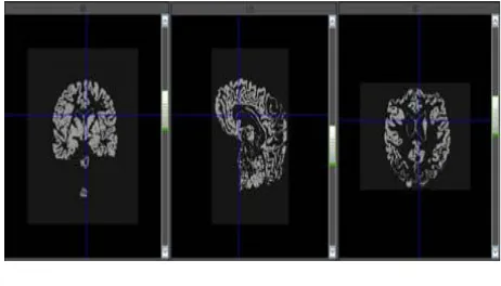 Figure 2 Output after Segmentation 