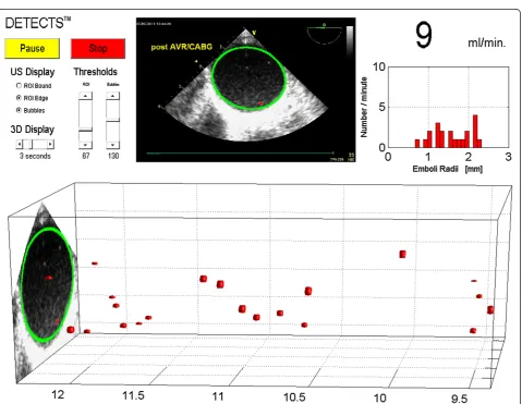 Figure 2 TEE image of the ascending aorta. (a)emboli identified by DETECTS Original TEE image, and (b) DETECTS™ display, of the ascending aorta