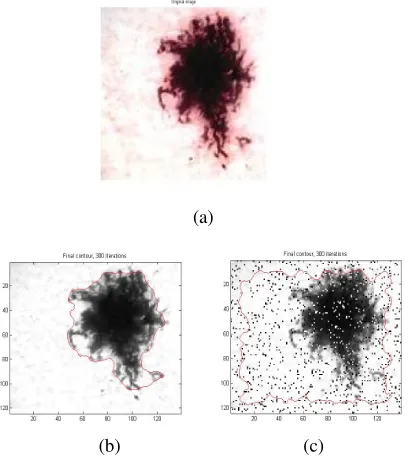 Figure 4. Demonstration of border detection for  Skin  Lesion 2 by the proposed   robust   segmentation algorithm  (a) Gray scale image