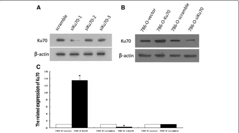 Figure 1 Ku70 expression was measured in the stable 786-O cell lines. A: Effect of various siRNAs on Ku70 expression was analysed byWestern blot in 786-O cells
