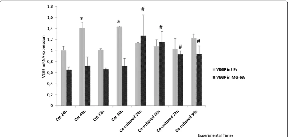 Figure 2 Real Time PCR for YKL-40. Expression of HFs and MG-63 cells independently grown and co-cultured