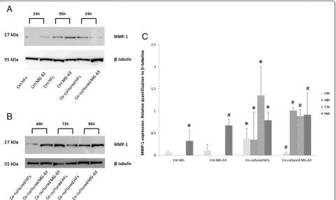 Figure 4 Western Blot for MMP1. (A) MMP1 expression of HFs and MG-63 cells independently grown and (B) co-cultured