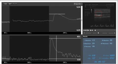 Figure 3 Example of automatic edge detection and real-time analysis of B-mode and doppler signal during flow mediated dilation(FMD) assessment (top right)