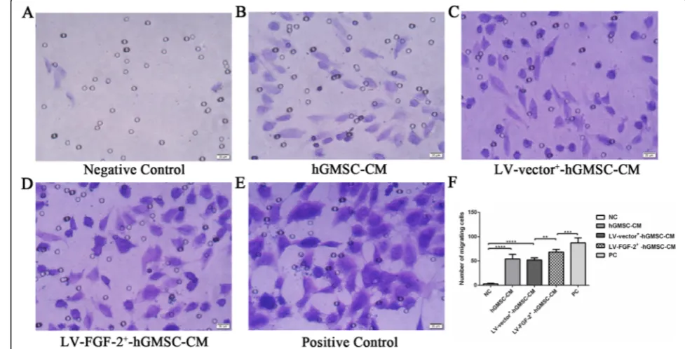 Fig. 4 The effect of LV-FGF-2+-hGMSC-CM on the migration of HUVECs. HUVECs were cultured in the upper chamber of the transwell chamberswith 0.1% FBS, and 0.1% FBS (NC), 0.1% FBS + hGMSC-CM, 0.1% FBS + LV-vector+-hGMSC-CM, 0.1% FBS + LV-FGF-2+-hGMSC-CM, or 