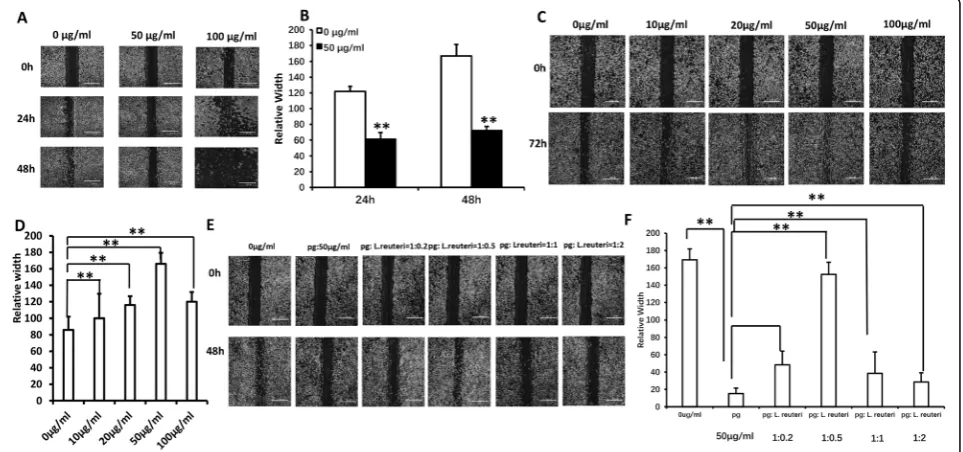 Fig. 1 The balance between pathogenic bacteria and probiotics restored GMSC migration.that 50sonicated extracts was 1 to 0.5 (1, 50 a, b The cell scratch migration assay results showed μg/ml P
