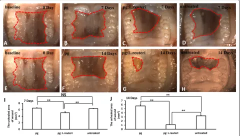 Fig. 4 The balance of oral pathogenic bacteria and probiotics promoted wound healing process in mice.Error bars represent SD ( a, e Macroscopic observation showedthat wound healing model of palate was established in mice after antibiotic treatment