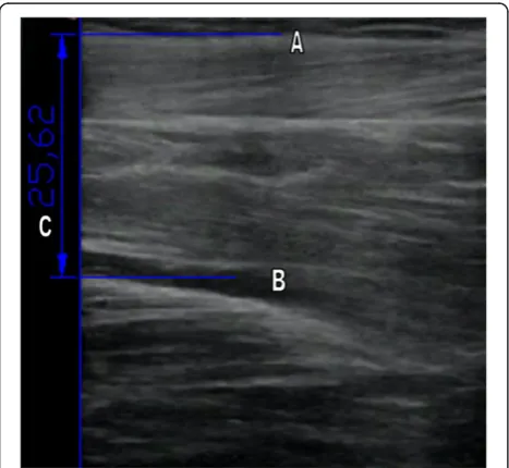 Figure 3 Image showing the measurement of the pennationangle of TA muscle. A. Connective tissue