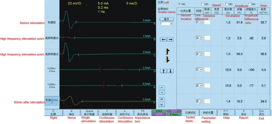 Figure 7 The sciatic nerve was total blocked when the current intensity reached 3 mA, 12 kHz stimulation