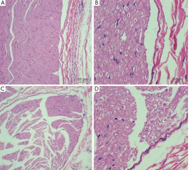 Figure 8 The hematoxylin-eosin (HE) staining of nerve tissue. Control group: (A, ×40; B, ×400), experimental group: (C, ×40; D, ×400)