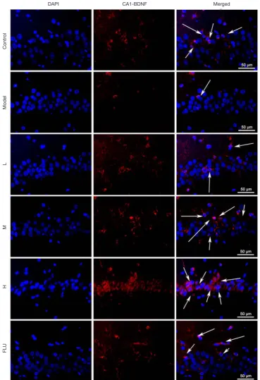 Figure 11 Effects of GXDSF on BDNF expression and representative images in the hippocampus CA1 region performed by fluorescence intensity of CA1 region BDNF expression in CUMS-induced rats