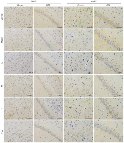 Figure 14 Effects of GXDSF on NGF expression and representative images in the cortex and hippocampus CA2 region performed by immunohistochemistry in the CUMS-induced rat model