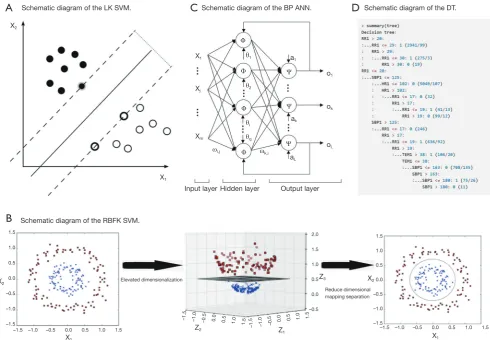 Figure 1 Schematic diagram of the advanced mathematical models. (A) Schematic diagram of the LK SVM; (B) schematic diagram of the RBFK SVM; (C) BP ANN model predicts exact patient regression based on MEWS