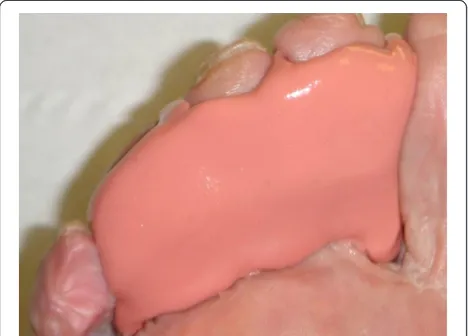 Figure 2 Gel toe prop. Gel toe props were similarly fitted to digitsize and plantigrade with 3rd metatarsal.