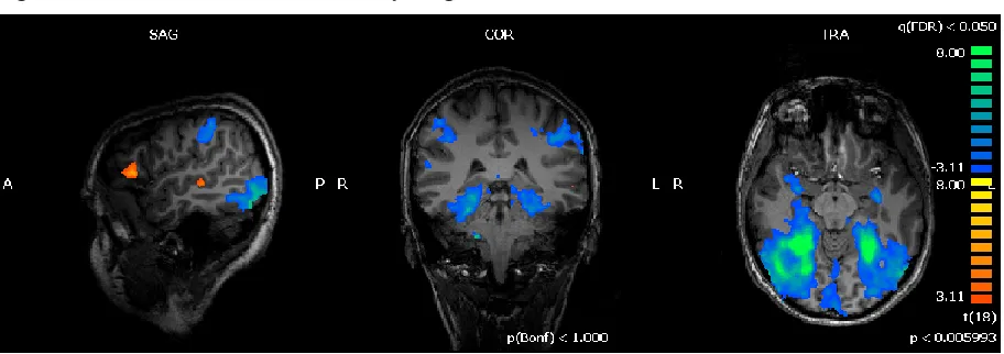 Figure 3.2.a Word vs Picture Context in young normal readers 