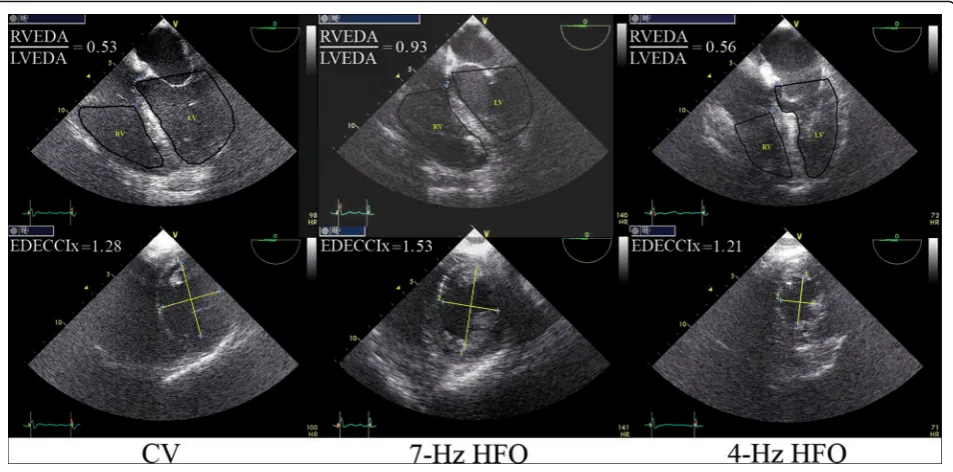 Fig. 2 Examples of transesophageal echocardiographic (TEE) determination of two primary study outcome variables