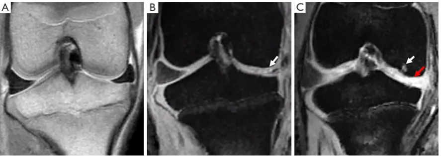 Figure 2 Biocompatibility and cellular uptake of SPIO. (A) Effects of SPIO on the cell viability after 24 h