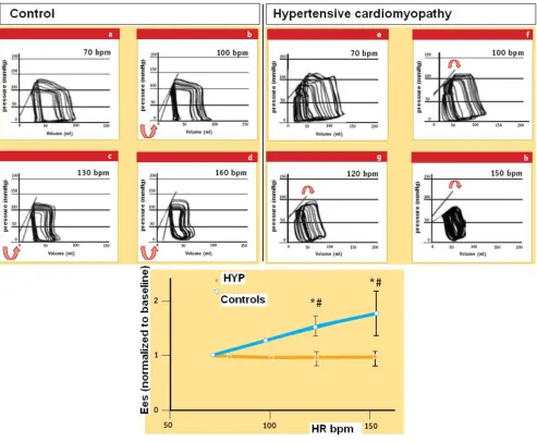 Figure 10Force-frequency relationship in the cath labForce-frequency relationship in the cath lab