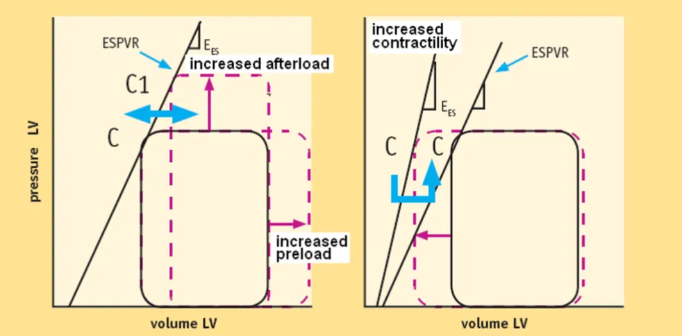 Figure 5Load changes at constant contractility (left) and contractility changes at constant load (right)Load changes at constant contractility (left) and contractility changes at constant load (right)