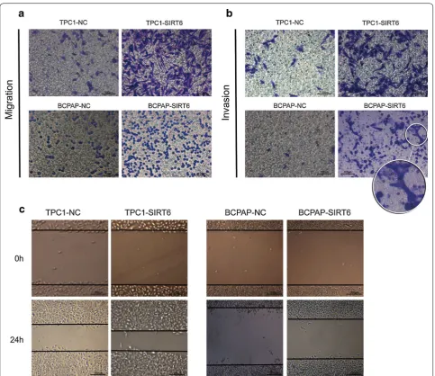 Fig. 3 Upregulating SIRT6 increased PTC cell migration and invasion. a TPC1-SIRT6 and BCPAP-SIRT6 showed significant increases in migration ability