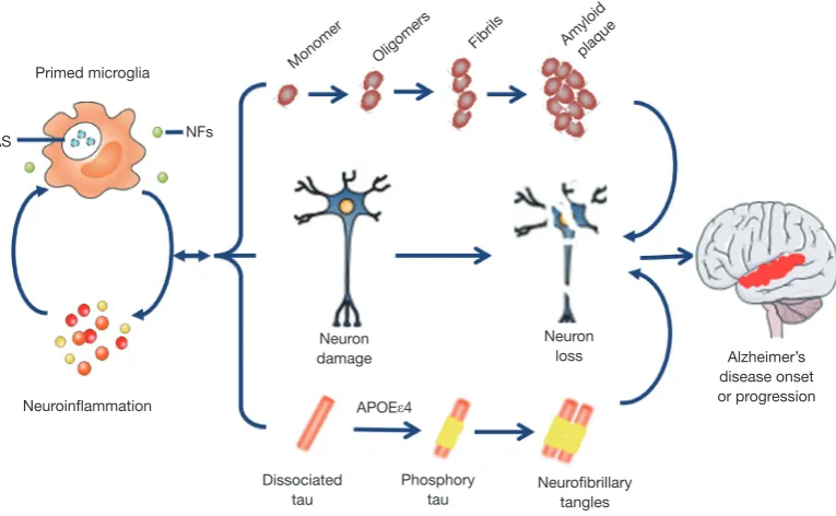 Figure 2 Microglial priming and AD. At early stage, primed microglia enhances the ability of phagocytosis and releases more NFs to microglia, directly and indirectly, result in neuron damage and loss, the main cause of AD onset or progression