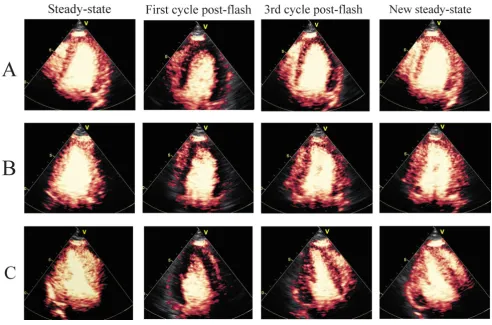 Figure 2Some selected end-systolic images from destruction-replenishment sequencesSome selected end-systolic images from destruction-replenishment sequences