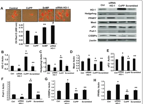 Figure 5 Effect of heme oxygenase-1(HO-1) induction and suppression on adipogenic markers