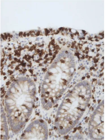 Figure 3 Pathologists’ diagnostic challenge: to accept MCi and to use special stains—that is the question