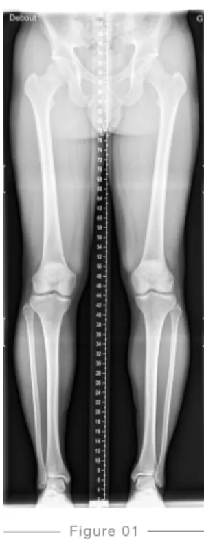 Figure 01 Full-length standing 