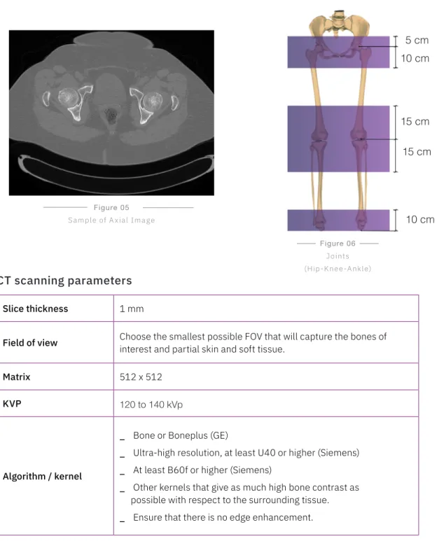 Figure 05 Sample of A xial Image