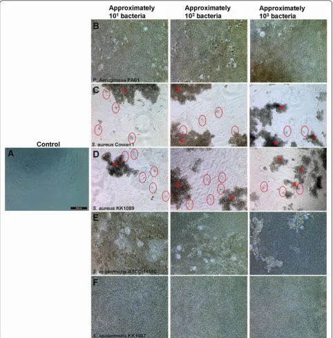 Figure 1 Total dissipation of human bone marrow-derived mesenchymal stem cells (BMMSCs) by bacterial infection