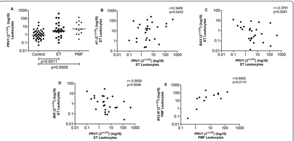 Figure 6 PRV1 expression versus JAK2 V617F mutation. (A) PRV1 expression was higher in ET JAK2 V617F positive patients than in JAK2V617F negative patients; (B) a positive correlation between PRV1 expression in ET leukocytes and JAK2 V617F allele burden per